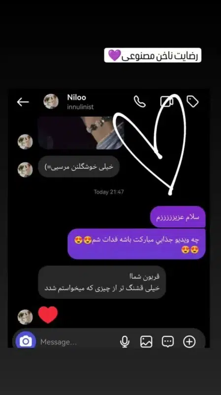 رضایت از خرید ناخن مصنوعی راسا