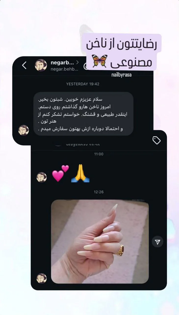 رضایت مشتری از ناخن مصنوعی راسا - عکس ۳