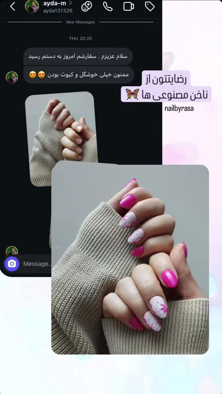 رضایت مشتری از ناخن مصنوعی راسا - عکس ۱